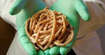 parazīti, kas iegūti no cilvēka ķermeņa