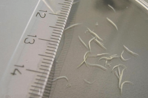 kā noņemt pinworms no bērna