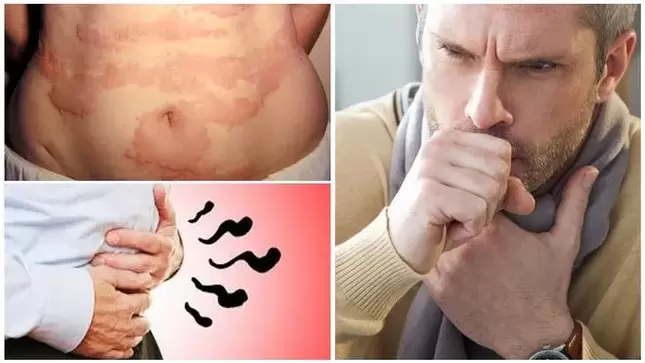 Alerģijas, klepus un vēdera uzpūšanās liecina par tārpu izraisītiem ķermeņa bojājumiem